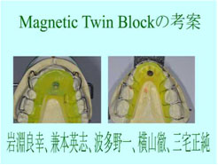 ビスケ様 ツインブロック機能療法 顎顔面整形治療における矯正歯科的応用