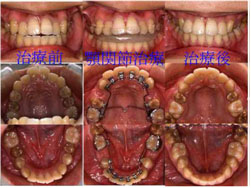 低料金を目指し矯正歯科へようこそ！