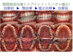 低料金を目指し矯正歯科へようこそ！