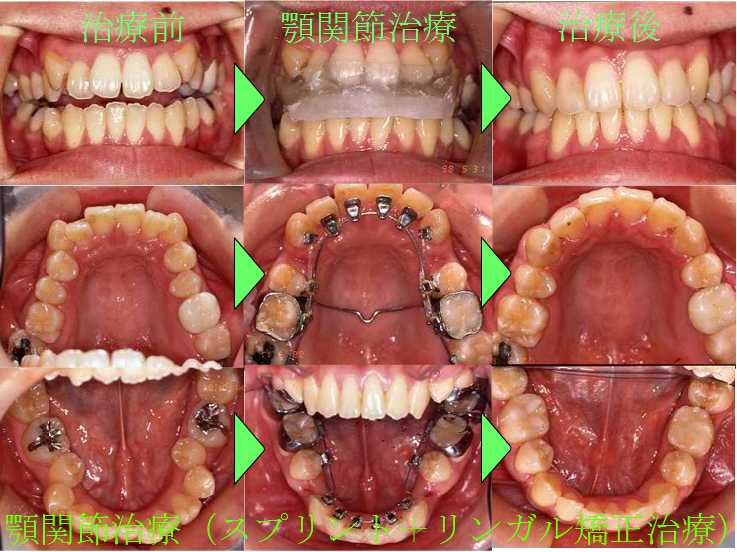 低料金を目指し矯正歯科へようこそ！