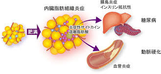 脂肪中心仮説